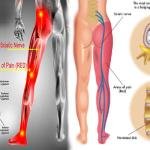 Back and Leg Nerve Comfort Support Pack | Supplements for Sciatic Discomfort in Ghana